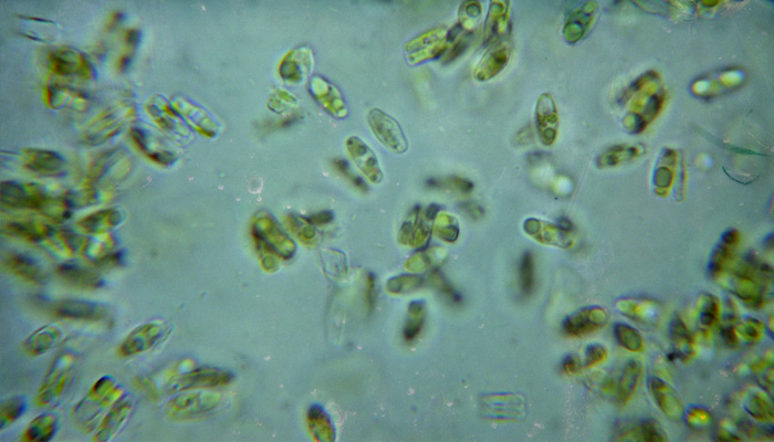 algal-lab-culture