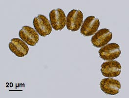 The chain-forming dinoflagellate, Alexandrium monilatum.