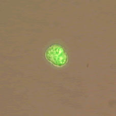 Fig 2. Light micrograph of Pfiesteria piscicida swimming cell after sonification at high power for one minute. Sonicated cells shed their flagella and formed immobile temporary cysts. Cells were stained with fluorescein diacetate (FDA). Live cells fluoresce green.